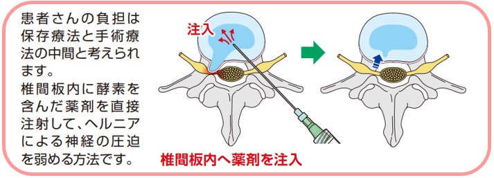 椎間板内酵素注入療法2